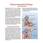 Decompression Illness (Article)